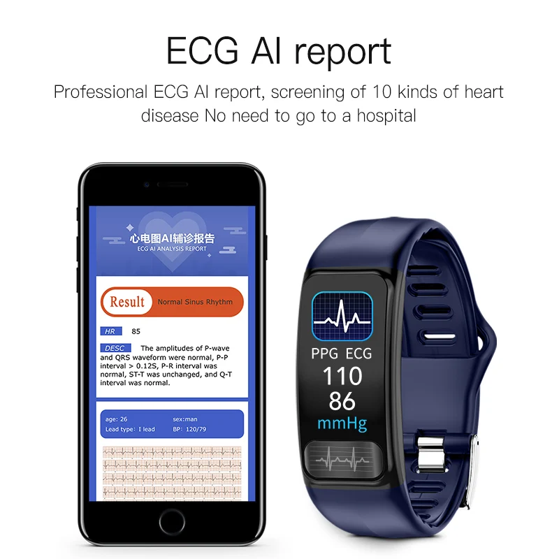 Reloj Inteligente Tipo Pulsera - Couple Watches Smartwatch reseña y precio